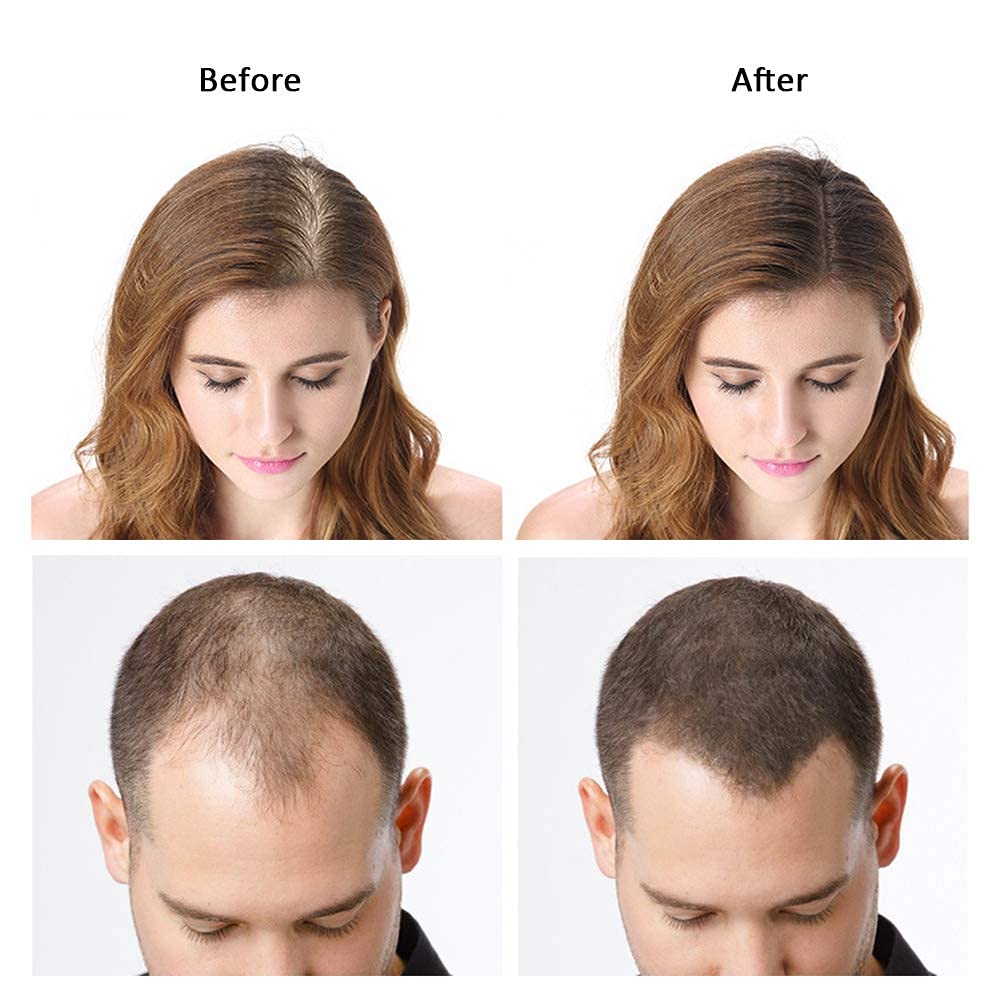 Dexe Hair Building Fibers Black | For Men & Women