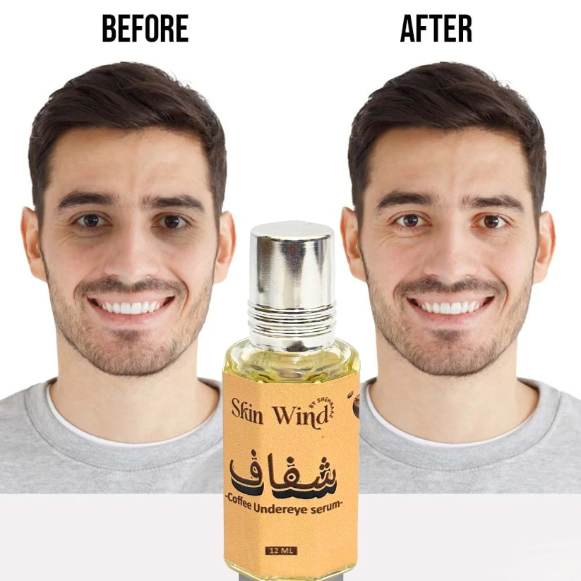 Shafaf Coffee Dark Circle Serum - 100% Result in 2 Weeks